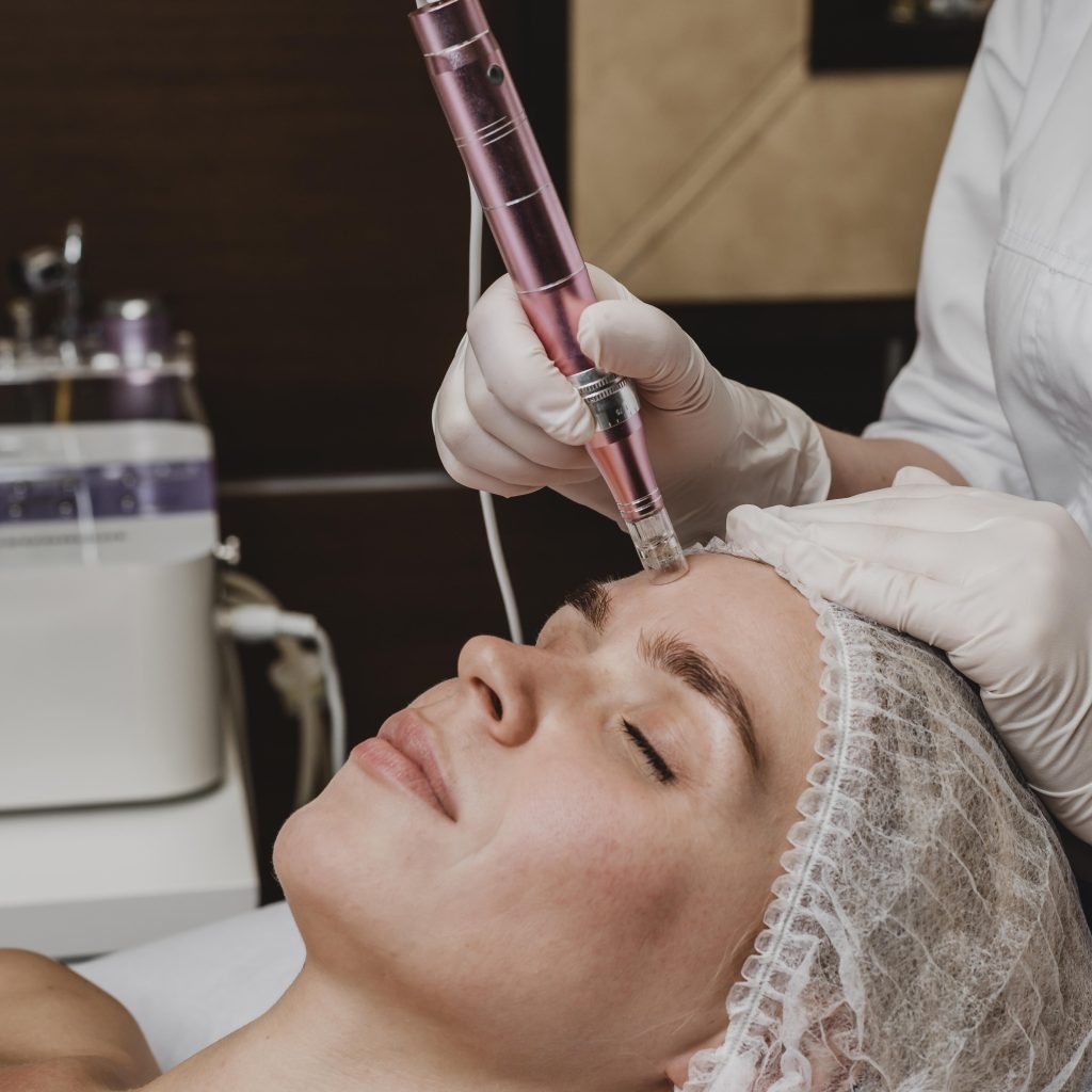 Microneedling | Skin Treatment